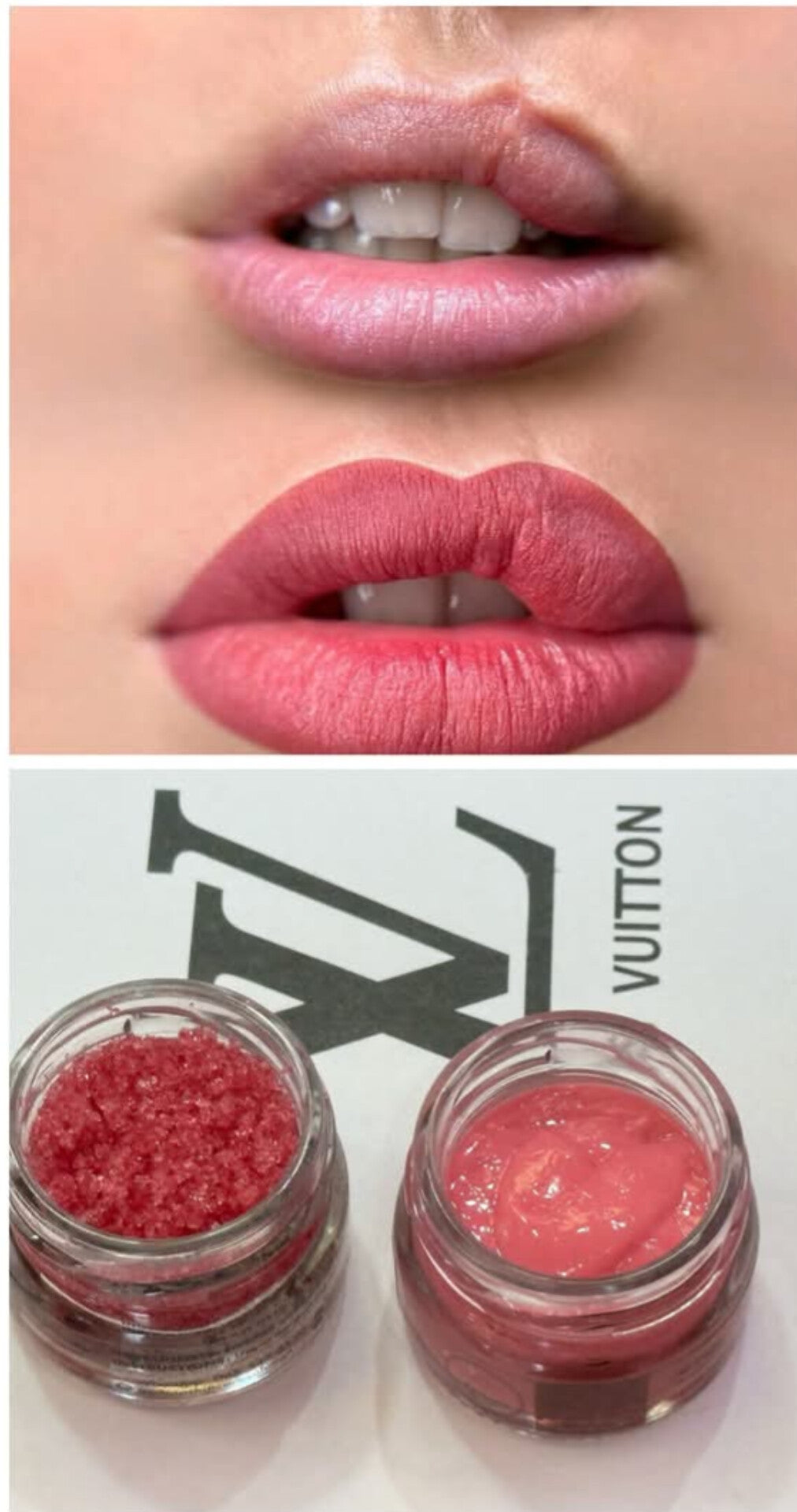 Lip Balm & Lip Scrub Combo